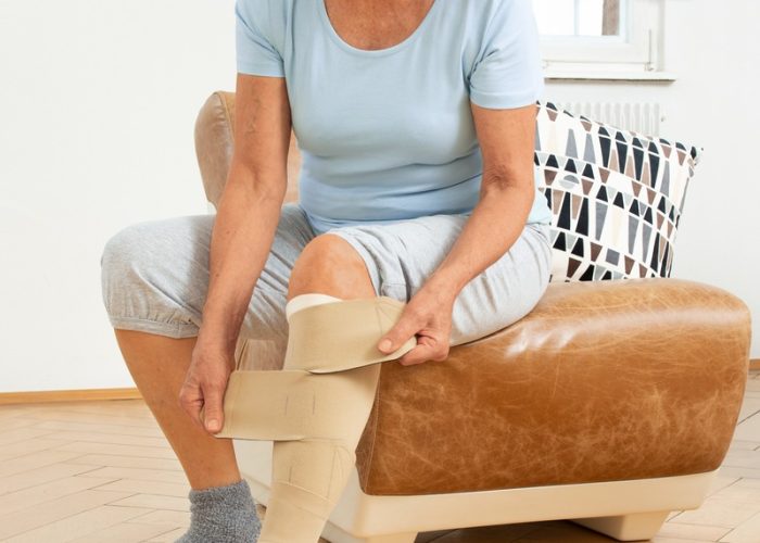 Die circaid Produkte von medi können nach Einweisung durch geschultes Fachpersonal vom Patienten selbstständig an- und abgelegt werden. / Weiterer Text über ots und www.presseportal.de/nr/23931 / Die Verwendung dieses Bildes ist für redaktionelle Zwecke unter Beachtung ggf. genannter Nutzungsbedingungen honorarfrei. Veröffentlichung bitte mit Bildrechte-Hinweis.